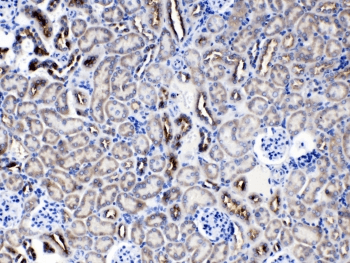 Polyclonal Rabbit anti-Human SERPINA5 / PCI Antibody (IHC, WB)