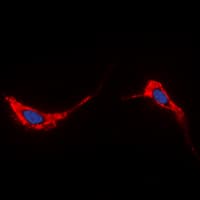 IHC-plus™ Polyclonal Rabbit anti-Human AQP2 / Aquaporin 2 Antibody (C-Terminus, IHC, IF, WB)