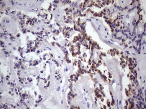 DMRT1 Antibody (aa1-210, clone OTI4B5, Carrier-free)