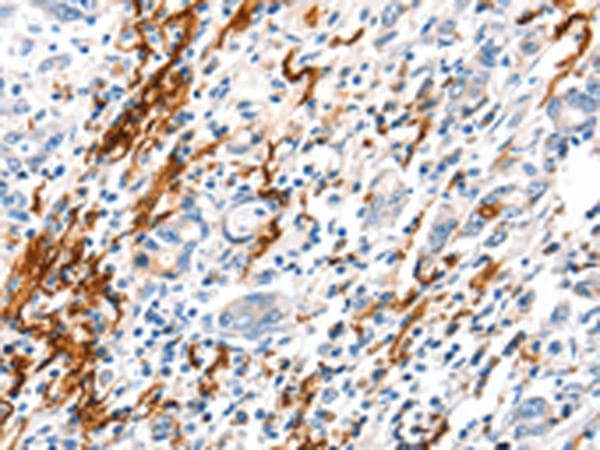 VTN / Vitronectin Antibody
