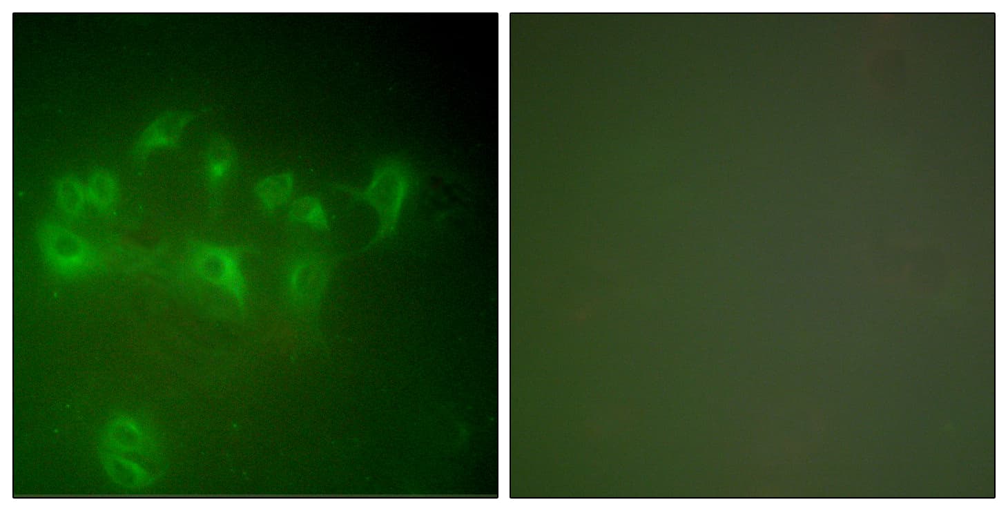 MDM2 Antibody (aa391-440)