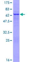 Human TSTA3 / GDP-L-Fucose Synthase Protein (Recombinant GST)