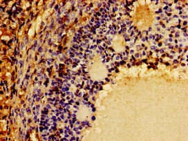 CSF2RB / CD131 Antibody
