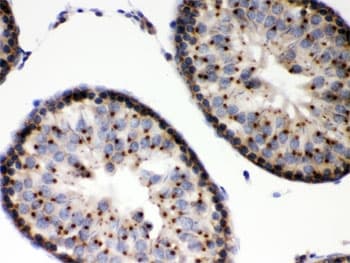 EBAG9 / RCAS1 Antibody
