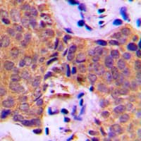 CTTN / Cortactin Antibody (Internal)