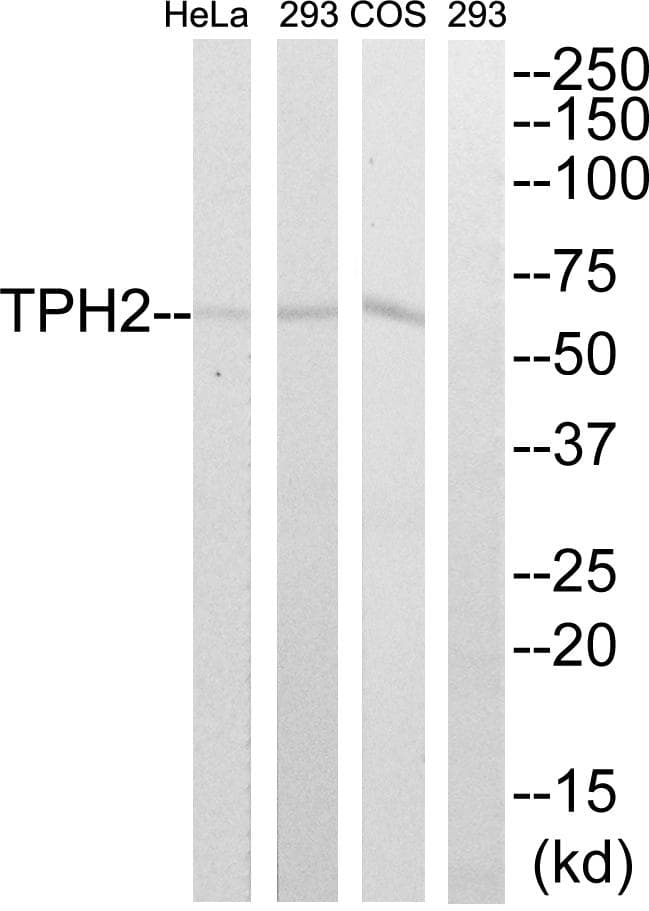 Polyclonal Rabbit anti-Human TPH2 Antibody (p19, IHC, WB)