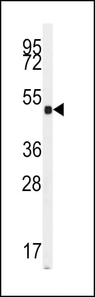 Polyclonal Rabbit anti-Human GUCY1A2 Antibody (aa105-136, IHC, WB)