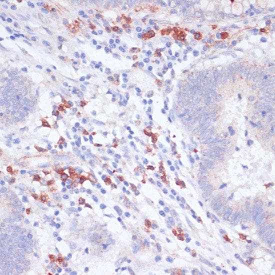 VASP Antibody