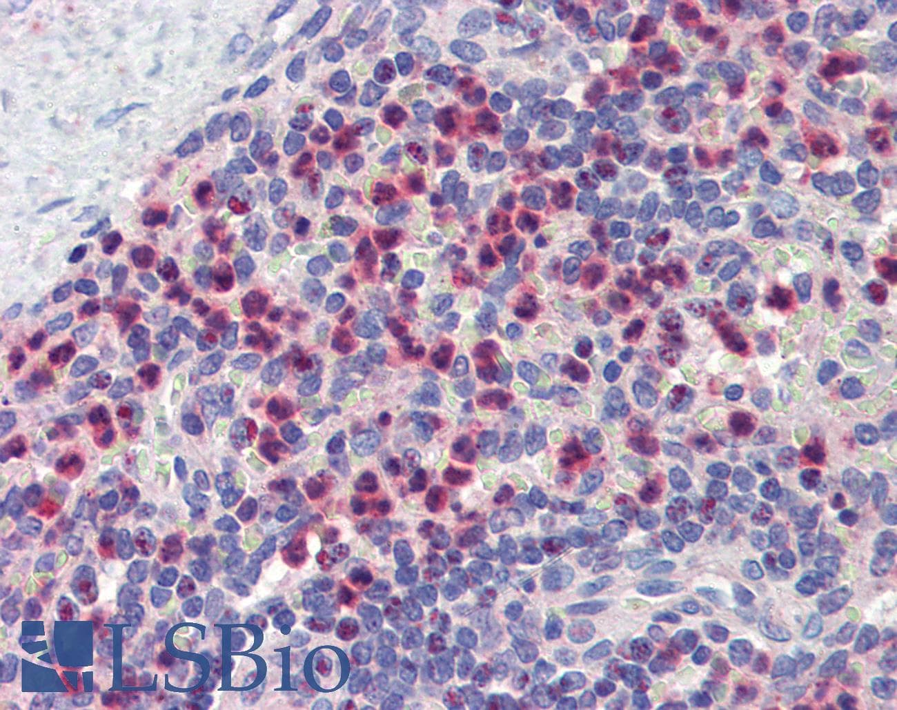 Polyclonal Rabbit anti-Human GABARAPL1 / ATG8 Antibody (N-Terminus, IHC, WB)