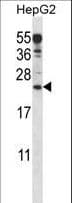 ANKRD22 Antibody (aa140-169)