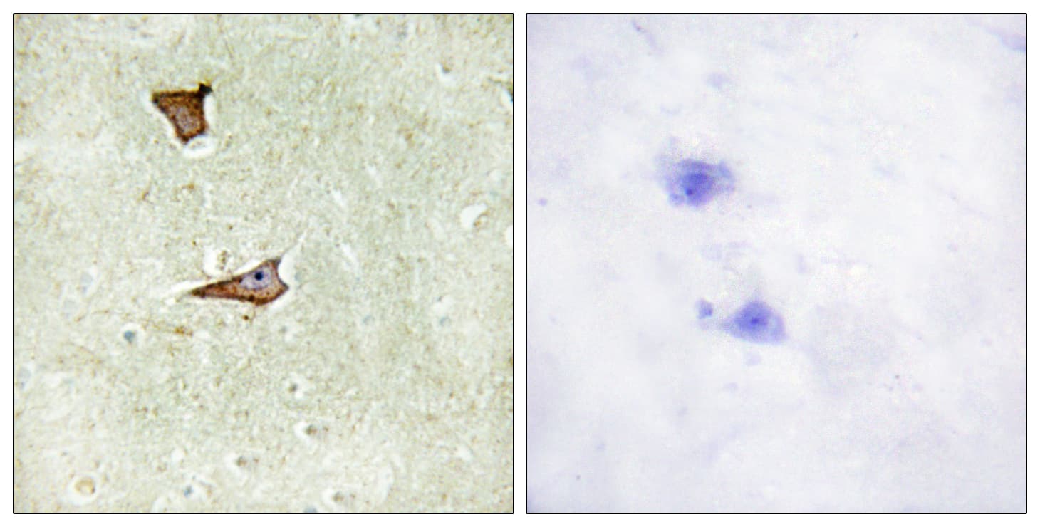IGF2R / CD222 Antibody (phospho-Ser2409)