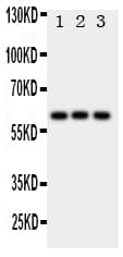 Polyclonal Rabbit anti-Human HEXA Antibody (aa191-207, IHC, WB)