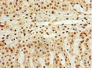 STK32A Antibody (aa1-166)