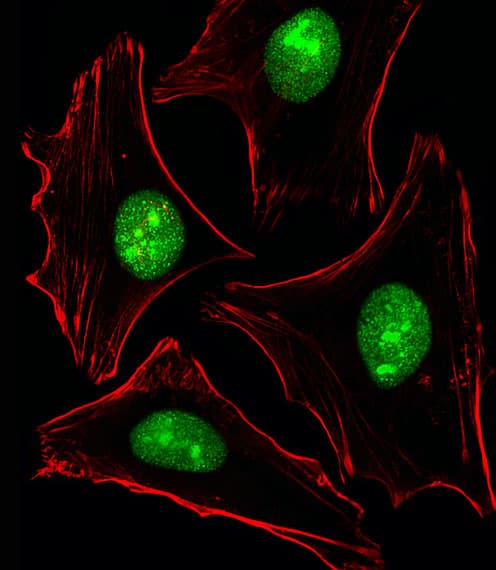 PTK2B / PYK2 Antibody (aa805-838)