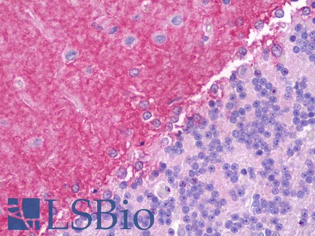 IHC-plus™ Polyclonal Goat anti-Human JAG1 / Jagged 1 Antibody (aa1197-1210, IHC, IF)