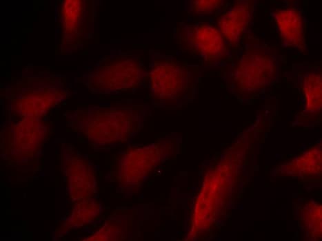 Polyclonal Rabbit anti-Human GATA1 Antibody (phospho-Ser310, IF, WB)