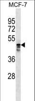 AP5M1 / C14orf108 Antibody (aa356-384)