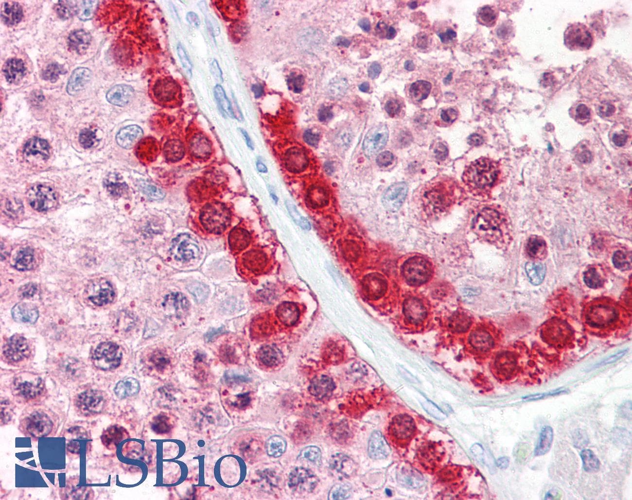 PathPlus™ Polyclonal Rabbit anti-Human MAGEA1 / MAGE 1 Antibody (aa260-309, IHC, WB)