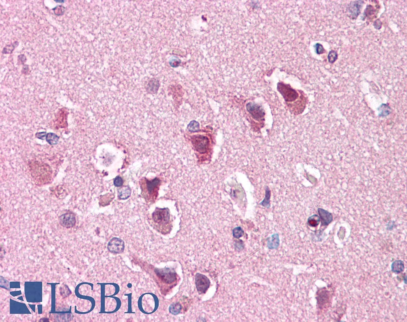 IHC-plus™ SLC29A1 / ENT1 Antibody (C-Terminus)