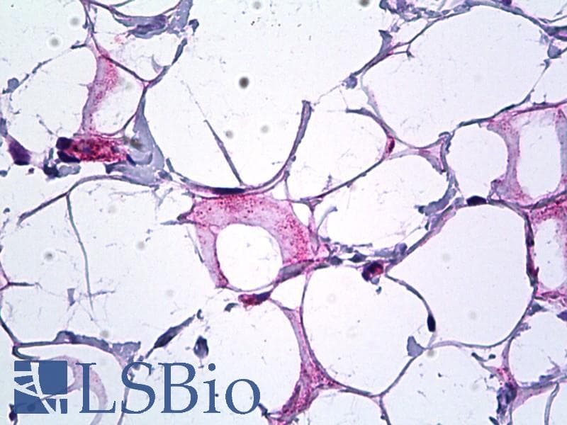 IHC-plus™ Polyclonal Rabbit anti-Human Endostatin Antibody (aa801-850, IHC, IF)