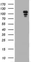 PR / Progesterone Receptor Antibody (clone OTI1G7)
