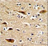 Polyclonal Rabbit anti-Human APP / Beta Amyloid Precursor Antibody (aa29-61, IHC, WB)