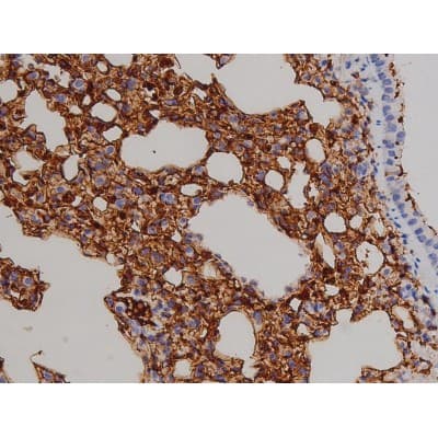 Polyclonal Rabbit anti-Human ZAP70 Antibody (phospho-Tyr319, IHC, IF, WB)