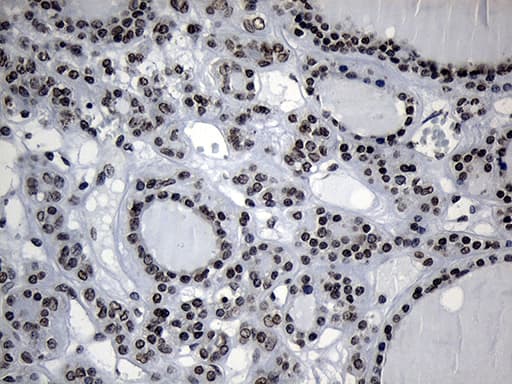 Monoclonal Mouse anti-Human ZNF705D Antibody (clone OTI1G1, IHC, WB)