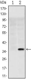 IHC-plus™ SLC22A1 Antibody (clone 2C5)
