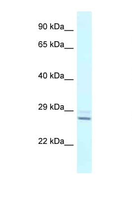 Polyclonal Rabbit anti-Human TPPP Antibody (N-Terminus, WB)