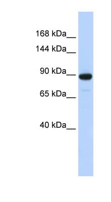 Polyclonal Rabbit anti-Human PDE3A Antibody (aa360-409, WB)