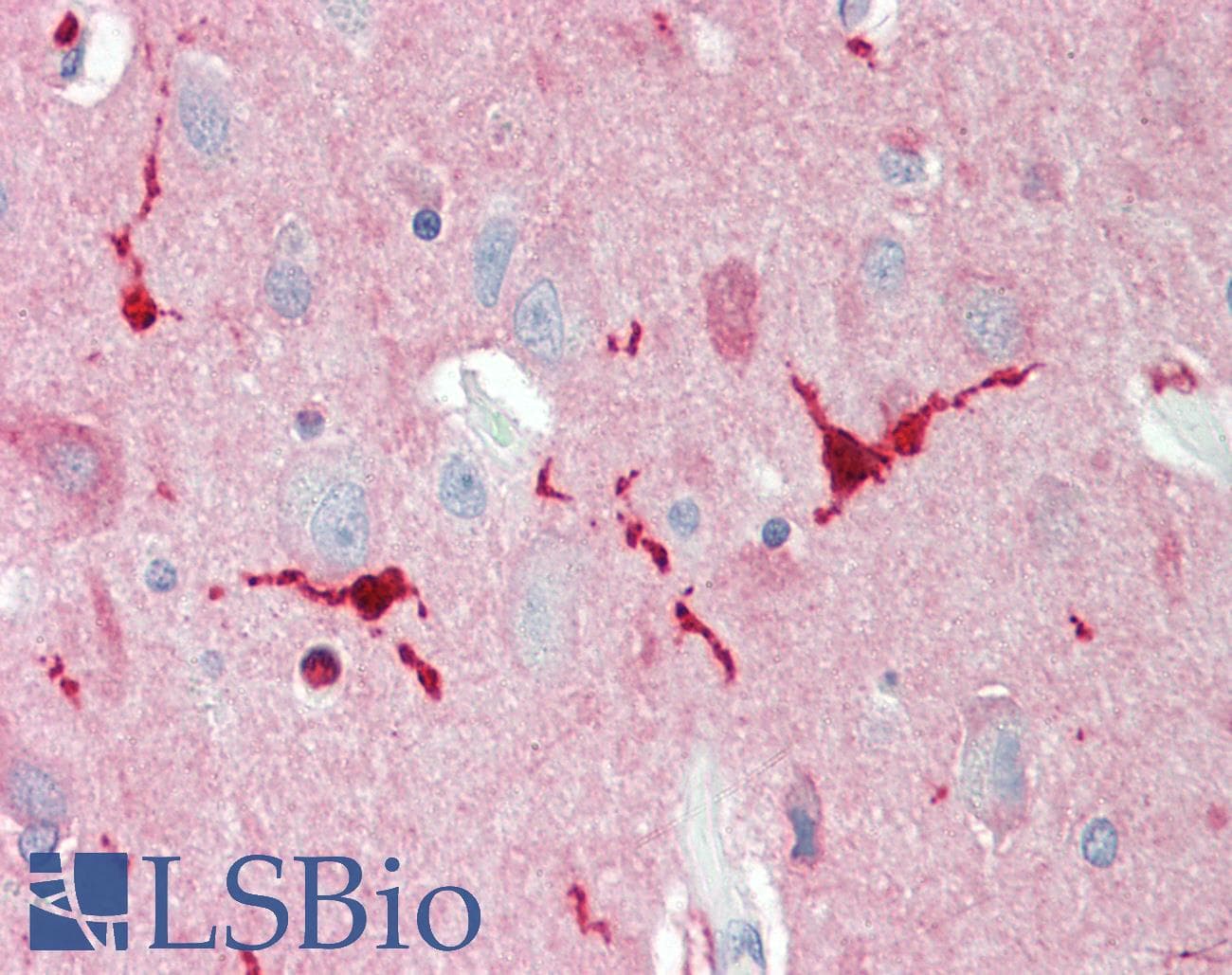 IHC-plus™ Polyclonal Rabbit anti-Human PON2 Antibody (aa79-107, IHC, WB)