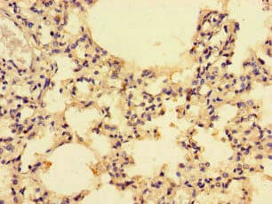 Polyclonal Rabbit anti-Human CCL4 / MIP-1 Beta Antibody (IHC)