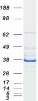 Human P5CR2 / PYCR2 Protein (Recombinant Myc-DDK (Flag))