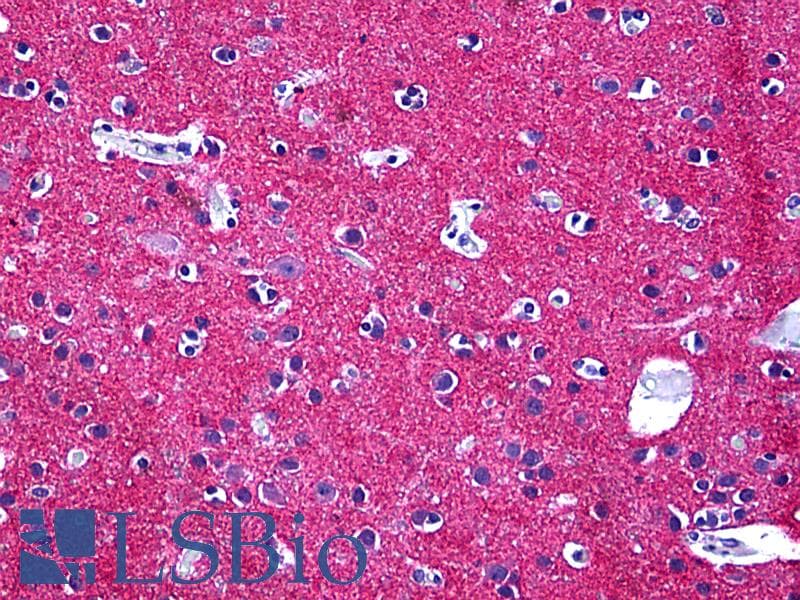 IHC-plus™ Monoclonal Mouse anti-Human STXBP1 / MUNC18-1 Antibody (clone 6D1, IHC, WB)