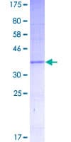 Human EMP1 Protein (Recombinant GST)