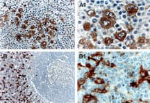 TRAF1 Antibody (aa1-22)