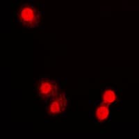 Polyclonal Rabbit anti-Human PML Antibody (N-Terminus, IHC, IF, WB)