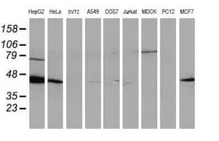 ARFGAP1 Antibody (clone OTI1H4)