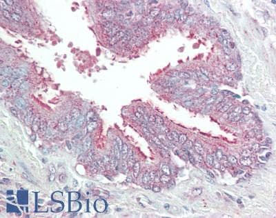 IHC-plus™ Polyclonal Rabbit anti-Human DEFB4A / BD-2 Antibody (aa1-64, IHC)