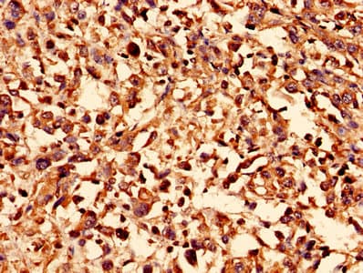 Polyclonal Rabbit anti-Human SLC2A4 / GLUT-4 Antibody (aa223-287, IHC, WB)
