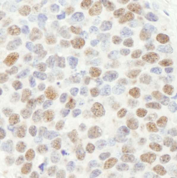MSH2 Antibody (aa875-C-term)