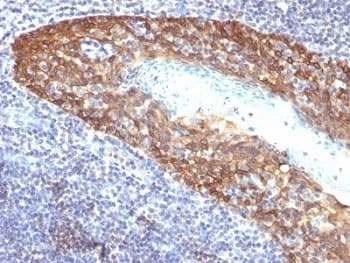 KRT14 / CK14 / Cytokeratin 14 Antibody (clone KRT14/532, Ready-to-Use)