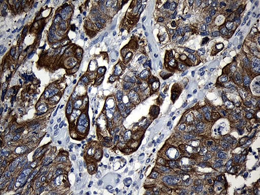 CPT1B Antibody (aa187-440, clone OTI2A6, Carrier-free)