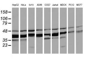 MAP2K3 / MEK3 / MKK3 Antibody (clone OTI6B12)