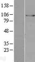 Human E6AP / UBE3A Protein (Over-Expression Lysate Myc-DDK (Flag))