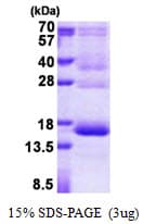 Human HBG1 / Fetal Hemoglobin Protein (Recombinant His,N-terminus)