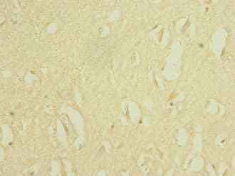 SCN8A / Nav1.6 Antibody