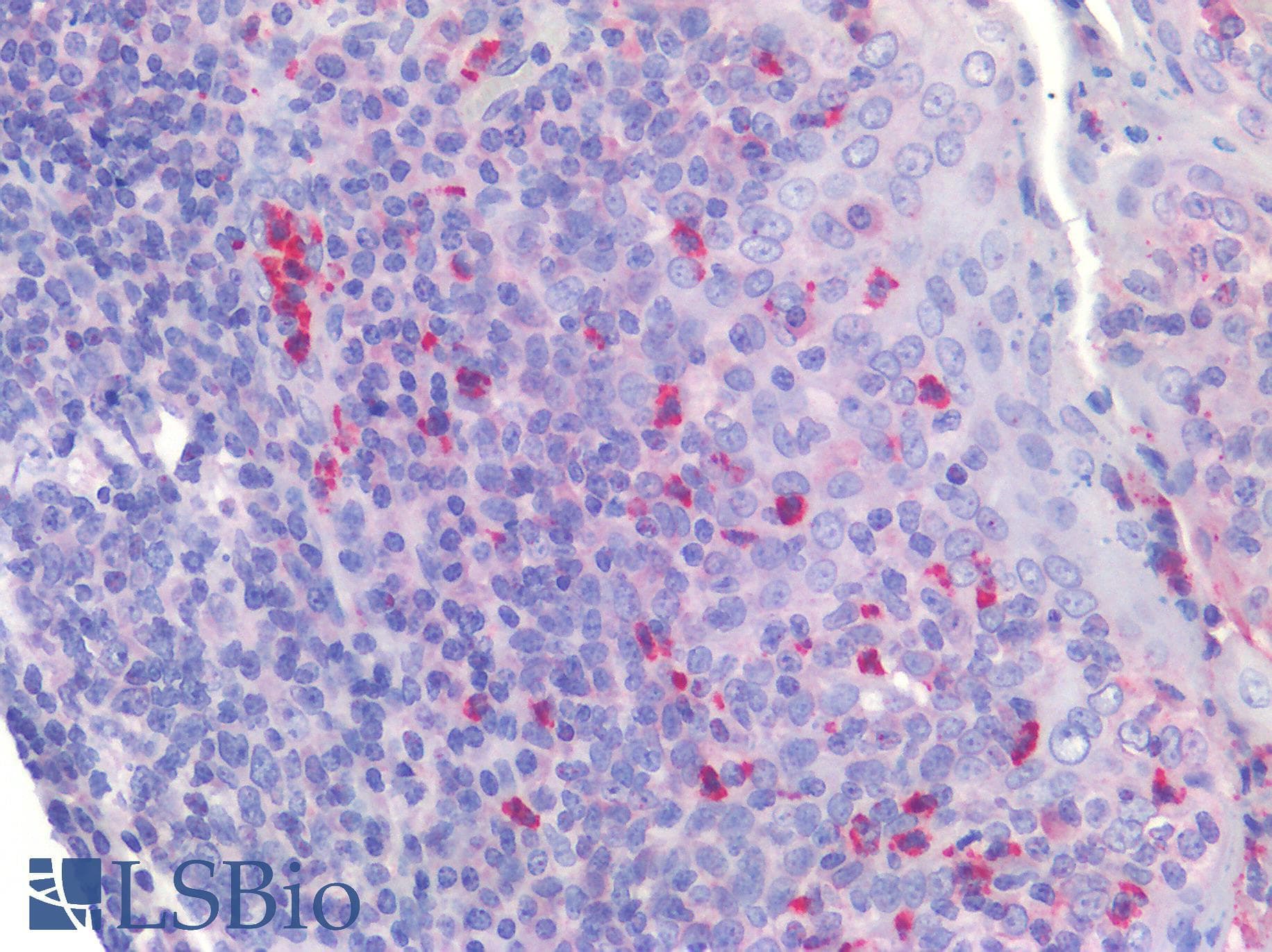 IHC-plus™ Polyclonal Rabbit anti-Human IL4 Antibody (IHC)