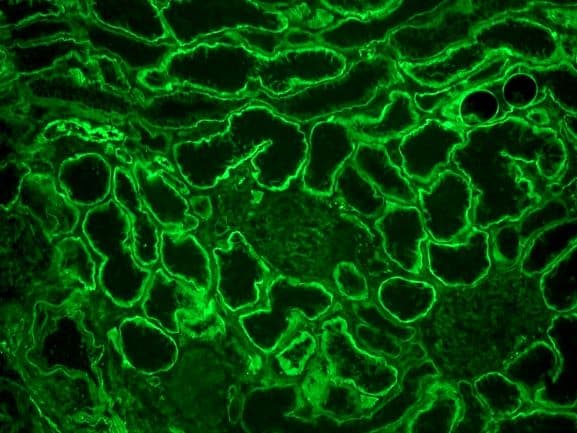 Monoclonal Rat anti-Human ITGA6/Integrin Alpha 6/CD49f Antibody (clone GoH3, IHC)
